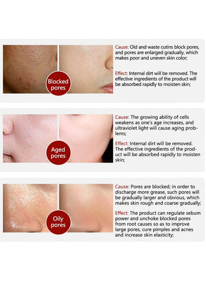 Sidr Pore Refining Serum